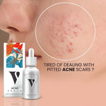 Acne Serum - Vcare Natural