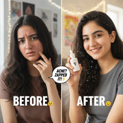 ایکنی سیرم - وی کیئر نیچرل