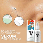 Acne Serum - Vcare Natural