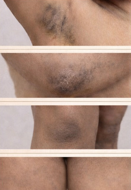 Private Parts Transformation Like You Always Wanted