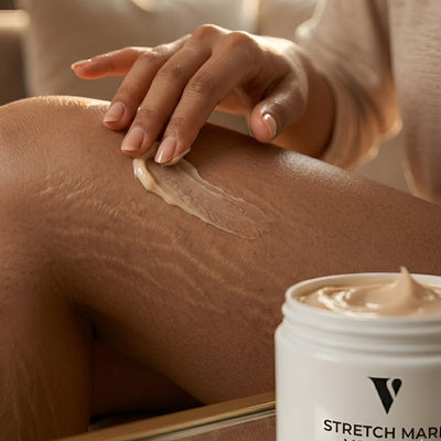 VCARE NATURAL Stretch Mark Cream - product view 1
