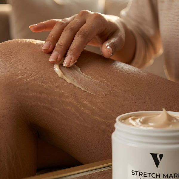 Stretch Mark Vanishing Cream