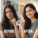 Clear and healthy-looking skin with regular acne serum use results before after