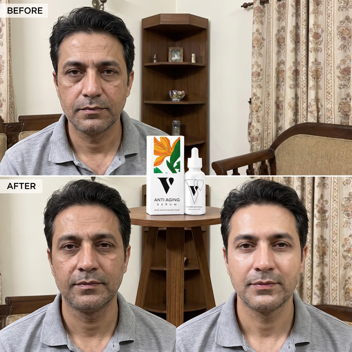 VCARE Natural Anti-Aging Serum 30ml before and after UGC with Pakistani man showing smoother refreshed-looking skinاینٹی ایجنگ سیرم - 30ml