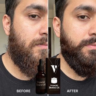 VCARE Natural Herbal Beard Oil 30ml before and after UGC with Pakistani man showing a softer groomed-looking beardBeard Oil Herbal For Men - 30ml