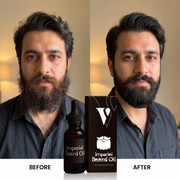 VCARE Natural Herbal Beard Oil 30ml before and after UGC with Pakistani man showing a softer groomed-looking beard side pose zoomBeard Oil Herbal For Men - 30ml