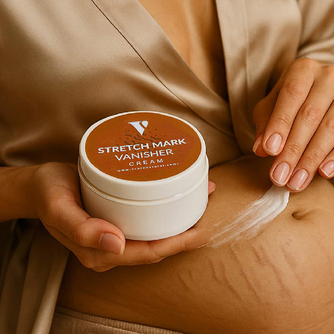 Stretch Mark Vanishing Cream