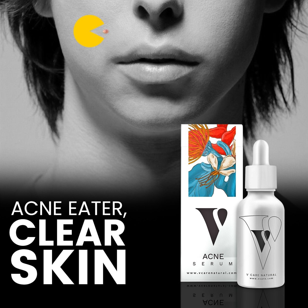 Acne Serum - Vcare Natural